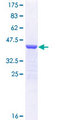 MYH7 Protein - 12.5% SDS-PAGE Stained with Coomassie Blue.