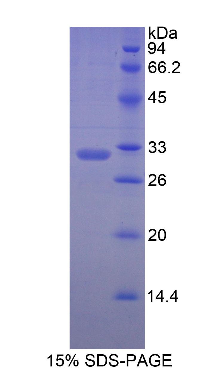 MYH7 Protein - Recombinant Myosin Heavy Chain 7, Cardiac Muscle, Beta By SDS-PAGE