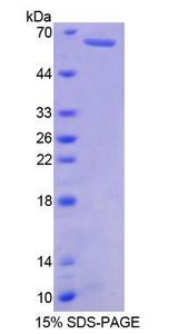 MYH7B Protein - Recombinant  Myosin Heavy Chain 7B, Cardiac Muscle Beta By SDS-PAGE