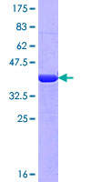 MYH9 Protein - 12.5% SDS-PAGE Stained with Coomassie Blue.