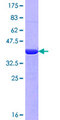 MYH9 Protein - 12.5% SDS-PAGE Stained with Coomassie Blue.