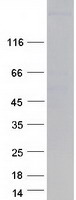 MYHC / MYH6 Protein - Purified recombinant protein MYH6 was analyzed by SDS-PAGE gel and Coomassie Blue Staining