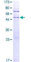 MYL10 Protein - 12.5% SDS-PAGE of human MYLC2PL stained with Coomassie Blue