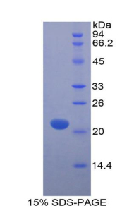 MYL12A / MRCL3 Protein - Recombinant Myosin Light Chain 12A By SDS-PAGE