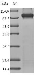 MYL3 Protein - (Tris-Glycine gel) Discontinuous SDS-PAGE (reduced) with 5% enrichment gel and 15% separation gel.