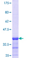 MYL3 Protein - 12.5% SDS-PAGE Stained with Coomassie Blue.