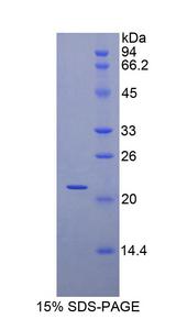 MYL3 Protein - Recombinant Myosin Light Chain 3, Alkali, Ventricular, Slow Skeletal By SDS-PAGE