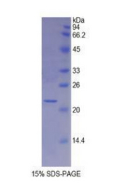 MYL4 Protein - Recombinant Myosin Light Chain 4, Alkali, Atrial, Embryonic By SDS-PAGE