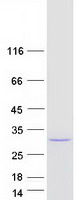 MYL4 Protein - Purified recombinant protein MYL4 was analyzed by SDS-PAGE gel and Coomassie Blue Staining