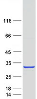 MYL4 Protein - Purified recombinant protein MYL4 was analyzed by SDS-PAGE gel and Coomassie Blue Staining