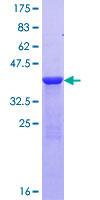 MYL6 Protein - 12.5% SDS-PAGE of human MYL6 stained with Coomassie Blue