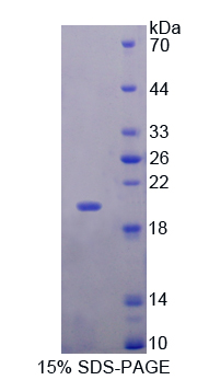 MYL6 Protein - Recombinant  Myosin Light Chain 6, Alkali, Smooth Muscle And Non Muscle By SDS-PAGE