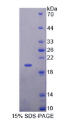 MYL6 Protein - Recombinant  Myosin Light Chain 6, Alkali, Smooth Muscle And Non Muscle By SDS-PAGE