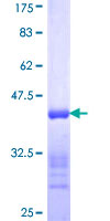 MYL6B Protein - 12.5% SDS-PAGE Stained with Coomassie Blue.