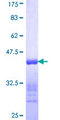 MYL6B Protein - 12.5% SDS-PAGE Stained with Coomassie Blue.