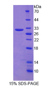 MYL6B Protein - Recombinant Myosin Light Chain 6B, Alkali, Smooth Muscle And Non Muscle By SDS-PAGE