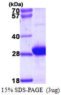 MYL6B Protein