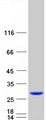 MYL6B Protein - Purified recombinant protein MYL6B was analyzed by SDS-PAGE gel and Coomassie Blue Staining