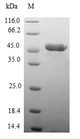 MYL7 Protein - (Tris-Glycine gel) Discontinuous SDS-PAGE (reduced) with 5% enrichment gel and 15% separation gel.