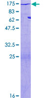 MYLK Protein - 12.5% SDS-PAGE of human MYLK stained with Coomassie Blue
