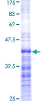 MYLK Protein - 12.5% SDS-PAGE Stained with Coomassie Blue.