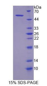 MYLK Protein - Recombinant Myosin Light Chain Kinase By SDS-PAGE