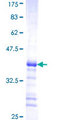 MYLK2 Protein - 12.5% SDS-PAGE Stained with Coomassie Blue.