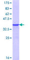 MYLK3 Protein - 12.5% SDS-PAGE Stained with Coomassie Blue.