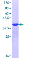 MYLK4 Protein - 12.5% SDS-PAGE Stained with Coomassie Blue.