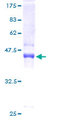 MYLPF Protein - 12.5% SDS-PAGE of human MYLPF stained with Coomassie Blue