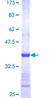 MYO1A Protein - 12.5% SDS-PAGE Stained with Coomassie Blue.