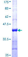 MYO1B / Myosin IB Protein - 12.5% SDS-PAGE Stained with Coomassie Blue.
