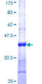 MYO1B / Myosin IB Protein - 12.5% SDS-PAGE Stained with Coomassie Blue.