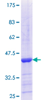 MYO1C Protein - 12.5% SDS-PAGE Stained with Coomassie Blue.
