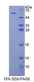 MYO1C Protein - Recombinant  Myosin IC By SDS-PAGE