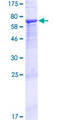 MYO1D Protein - 12.5% SDS-PAGE of human MYO1D stained with Coomassie Blue