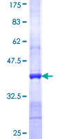 MYO1D Protein - 12.5% SDS-PAGE Stained with Coomassie Blue.