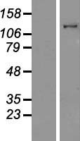 MYO1E / Myosin IE Protein - Western validation with an anti-DDK antibody * L: Control HEK293 lysate R: Over-expression lysate