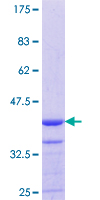 MYO1E / Myosin IE Protein - 12.5% SDS-PAGE Stained with Coomassie Blue.