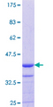 MYO1E / Myosin IE Protein - 12.5% SDS-PAGE Stained with Coomassie Blue.