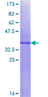 MYO1F Protein - 12.5% SDS-PAGE Stained with Coomassie Blue.
