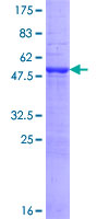 MYO3A Protein - 12.5% SDS-PAGE of human MYO3A stained with Coomassie Blue