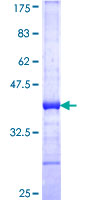 MYO3A Protein - 12.5% SDS-PAGE Stained with Coomassie Blue.