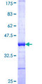MYO3A Protein - 12.5% SDS-PAGE Stained with Coomassie Blue.
