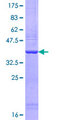 MYO5A / Myosin V Protein - 12.5% SDS-PAGE Stained with Coomassie Blue.