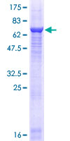 MYO5C Protein - 12.5% SDS-PAGE of human MYO5C stained with Coomassie Blue