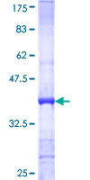 MYO7A / Myosin-VIIa Protein - 12.5% SDS-PAGE Stained with Coomassie Blue.