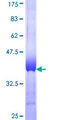 MYO7B Protein - 12.5% SDS-PAGE Stained with Coomassie Blue.