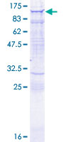 MYO9A Protein - 12.5% SDS-PAGE of human MYO9A stained with Coomassie Blue