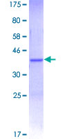 MYO9B Protein - 12.5% SDS-PAGE Stained with Coomassie Blue.